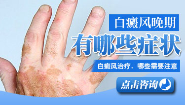 武汉泛发性白癜风发病初期的症状有哪些