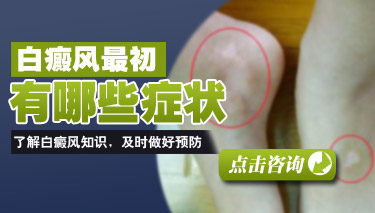 武汉白斑医院那家比较好，白斑都有哪些特点呢